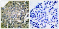 Endoplasmin Polyclonal Antibody