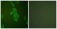 Enolase Polyclonal Antibody
