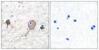Enolase Polyclonal Antibody