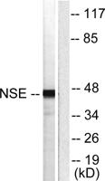 Enolase Polyclonal Antibody