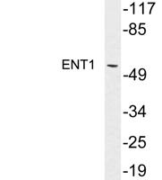 ENT1 Polyclonal Antibody