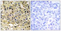 Enterokinase HC Polyclonal Antibody