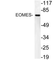 EOMES Polyclonal Antibody