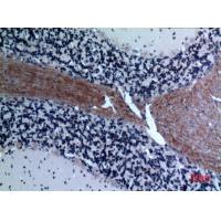 Eotaxin-3 Polyclonal Antibody