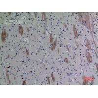 Eotaxin-3 Polyclonal Antibody