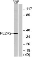 EP2 Polyclonal Antibody