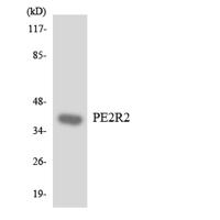 EP2 Polyclonal Antibody