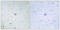 EP3 Polyclonal Antibody