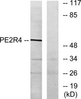 EP4 Polyclonal Antibody