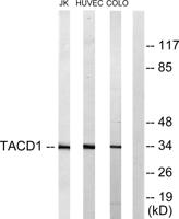EP-CAM Polyclonal Antibody