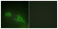 EphA1 Polyclonal Antibody