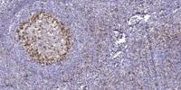 EphA1 Polyclonal Antibody