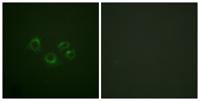 EphA2/3/4 Polyclonal Antibody