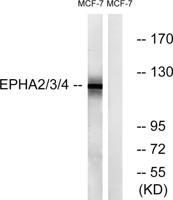 EphA2/3/4 Polyclonal Antibody