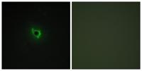 EphA6 Polyclonal Antibody