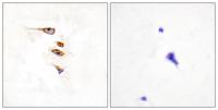EphA6 Polyclonal Antibody