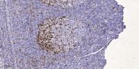EphA7 Polyclonal Antibody