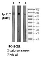 EphB1/2 Polyclonal Antibody