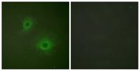 EphB1/2 Polyclonal Antibody