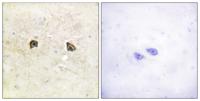 EphB1/2 Polyclonal Antibody