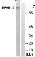 EphB1/2 Polyclonal Antibody