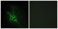 EphB1/2/3 Polyclonal Antibody