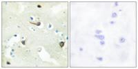 EphB1/2/3 Polyclonal Antibody