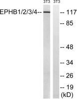 EphB1/2/3/4 Polyclonal Antibody