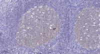 EphB1/2/3/4 Polyclonal Antibody