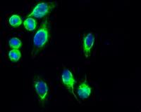 GFAP Polyclonal Antibody