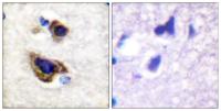 GFAP Polyclonal Antibody