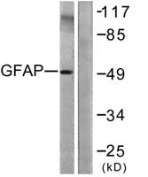GFAP Polyclonal Antibody