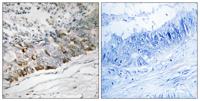 GFRP Polyclonal Antibody