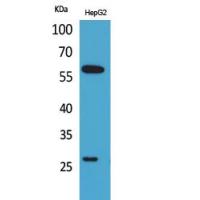 GGT1 Polyclonal Antibody
