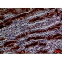 GGT1 Polyclonal Antibody