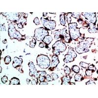 GH Polyclonal Antibody