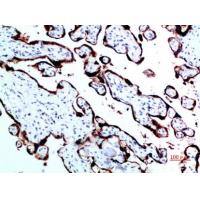 GH Polyclonal Antibody