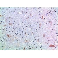 GH Polyclonal Antibody