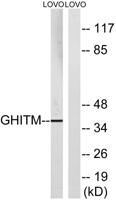 GHITM Polyclonal Antibody