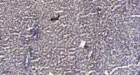 GHITM Polyclonal Antibody