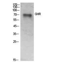 GHR Polyclonal Antibody