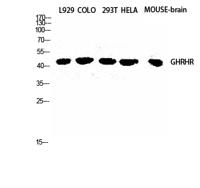 GHRH-R Polyclonal Antibody