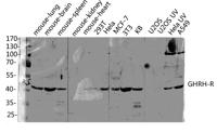GHRH-R Polyclonal Antibody