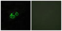 GHRH-R Polyclonal Antibody