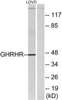 GHRH-R Polyclonal Antibody