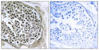 GIDRP88 Polyclonal Antibody