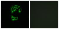 GIMAP2 Polyclonal Antibody