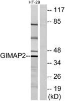 GIMAP2 Polyclonal Antibody