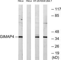 GIMAP4 Polyclonal Antibody