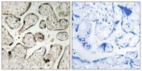 GIMAP5 Polyclonal Antibody
